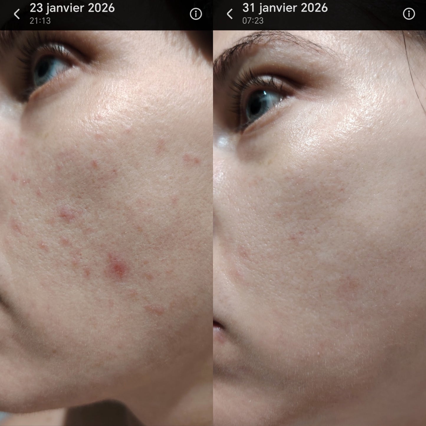 Crème de Nuit - Peeling Hévoé: Renouvelle et révèle l'éclat