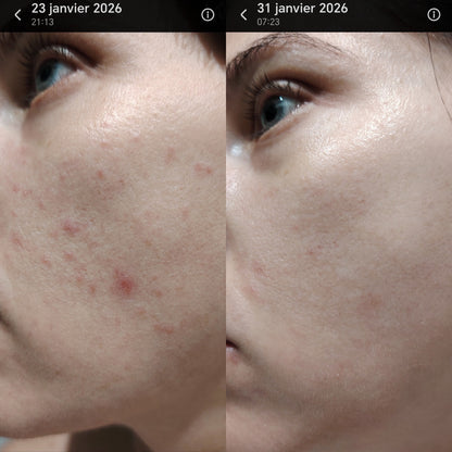 Crème de Nuit - Peeling Hévoé: Renouvelle et révèle l'éclat